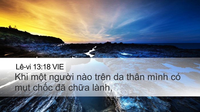 Lê-vi 13:18 VIE Desktop Wallpaper - Khi một người nào trên da thân mình có - Desktop Bible Verse Wallpaper