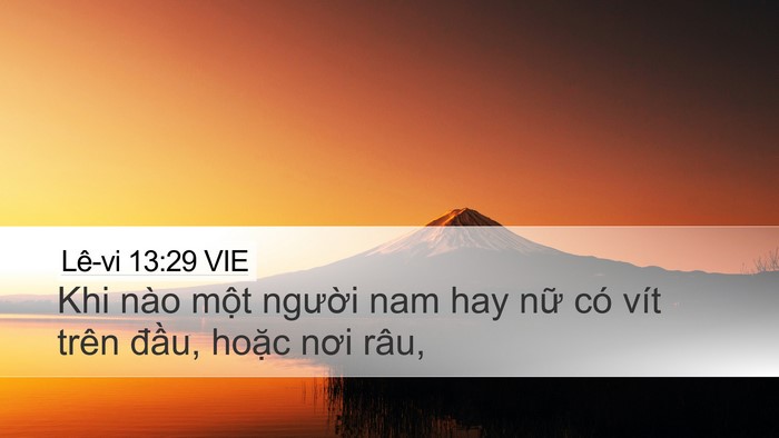 Lê-vi 13:29 VIE Bible Verse Image