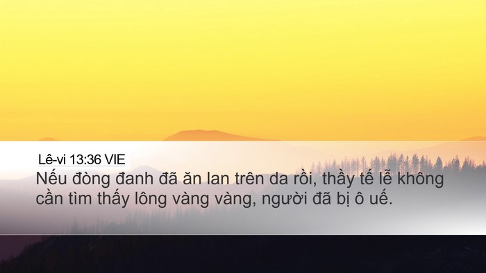Lê-vi 13:36 VIE Bible Verse Image