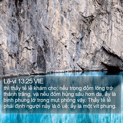 Lê-vi 13:25 VIE Bible Verse Image