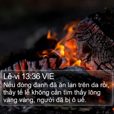Lê-vi 13:36 VIE Bible Verse Image