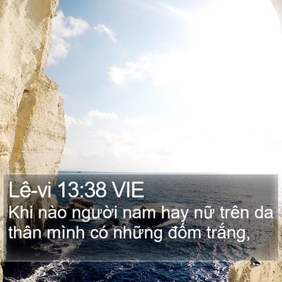 Lê-vi 13:38 VIE Bible Verse Image