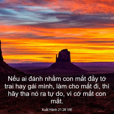 Picture 03 - Xuất Hành 21:26 VIE - Nếu ai đánh nhằm con mắt đầy tớ trai - Bible Verse Picture
