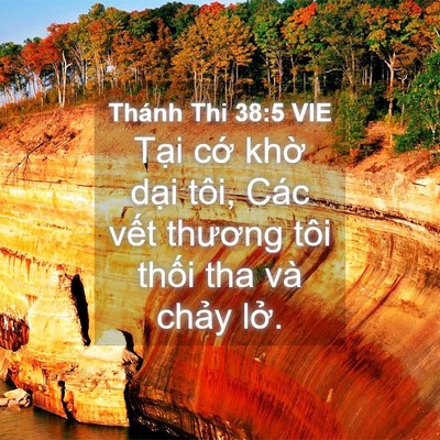 Picture 04 - Thánh Thi 38:5 VIE - Tại cớ khờ dại tôi, Các vết thương - Bible Verse Picture