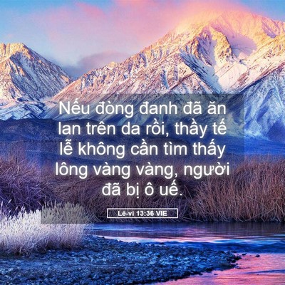 Picture 05 - Lê-vi 13:36 VIE - Nếu đòng đanh đã ăn lan trên da rồi, - Bible Verse Picture
