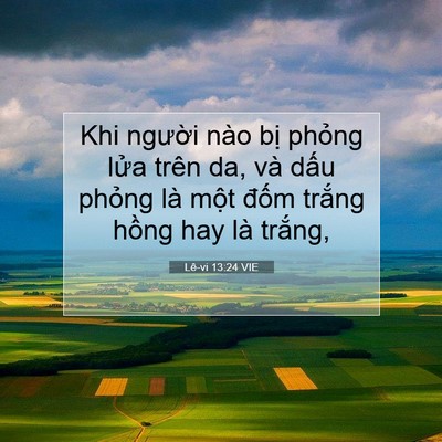 Picture 07 - Lê-vi 13:24 VIE - Khi người nào bị phỏng lửa trên da, - Bible Verse Picture
